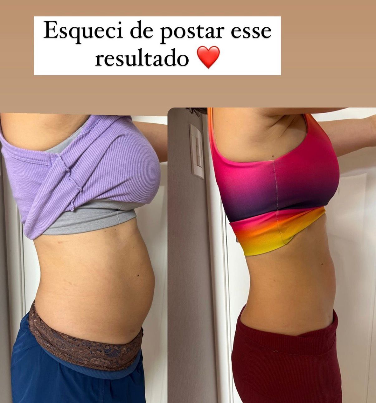 Aluna antes e depois, vista de lado: barriga estufada e depois cintura reta